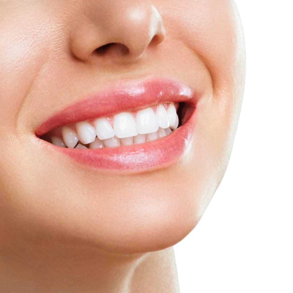 Implantes Dentales
