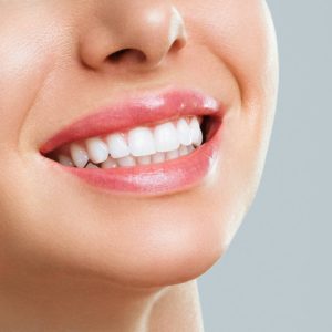 Blanqueamiento dental