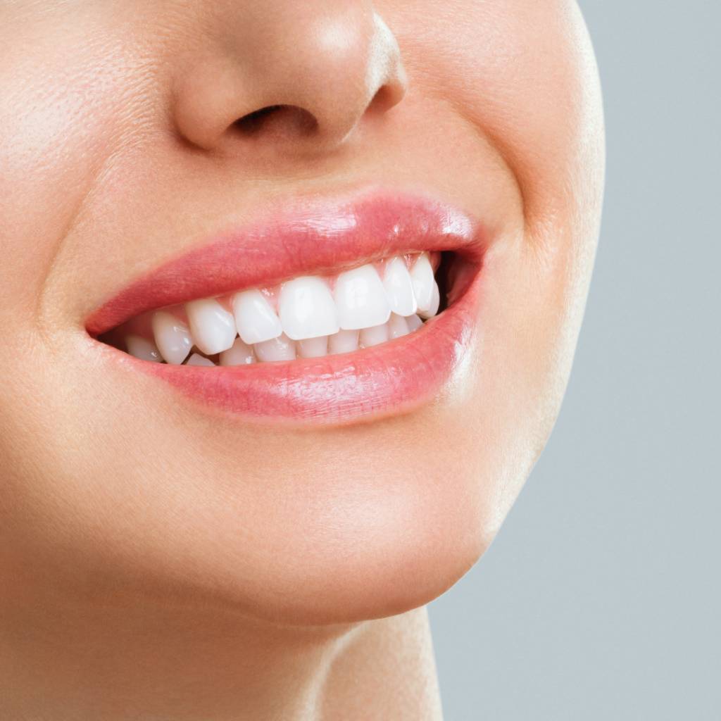 Blanqueamiento dental