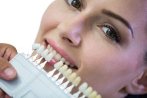 Blanqueamiento dental