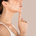 hilos tensores Silhouette Soft para combatir la flacidez facial