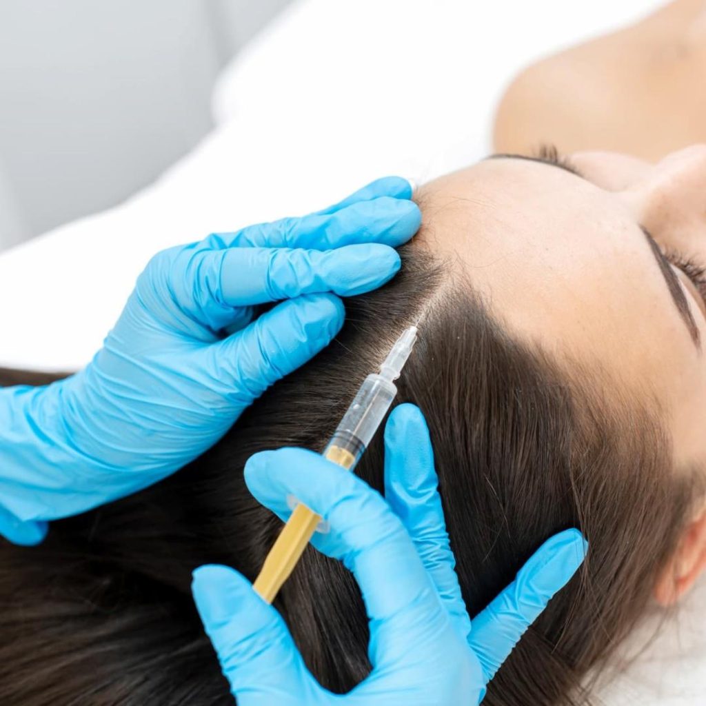 Mesoterapia capilar