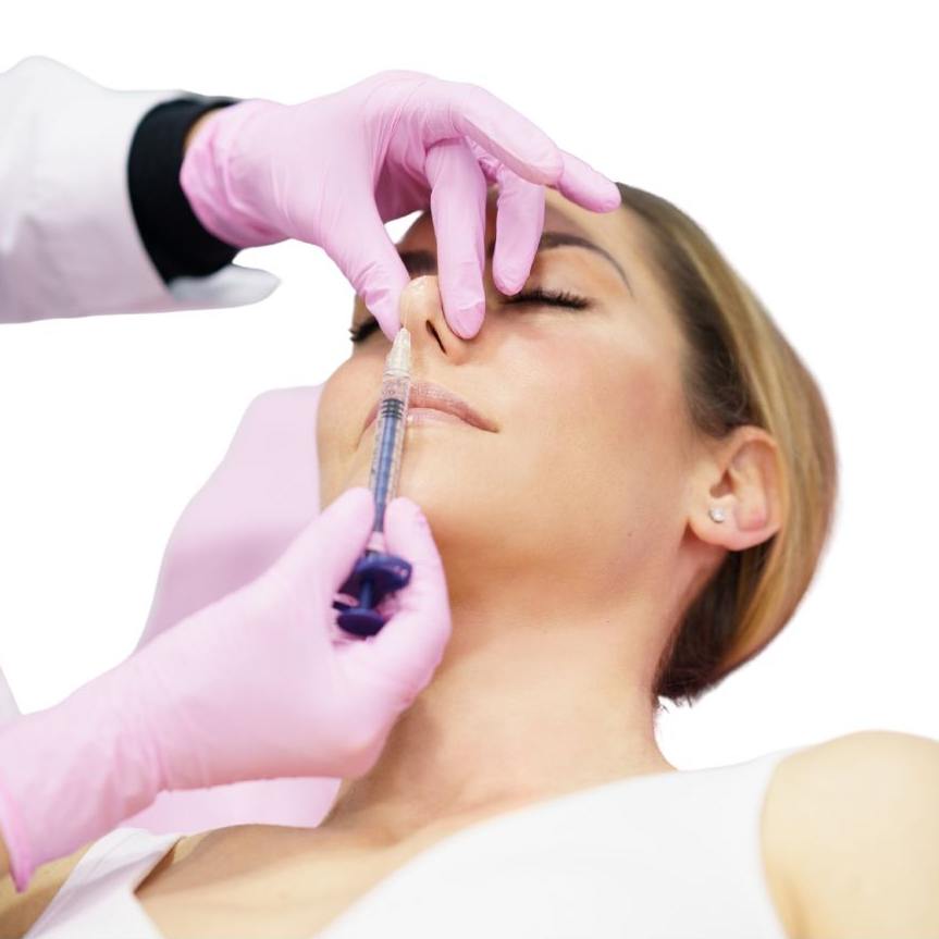 Rinomodelación o remodelación nasal sin cirugía