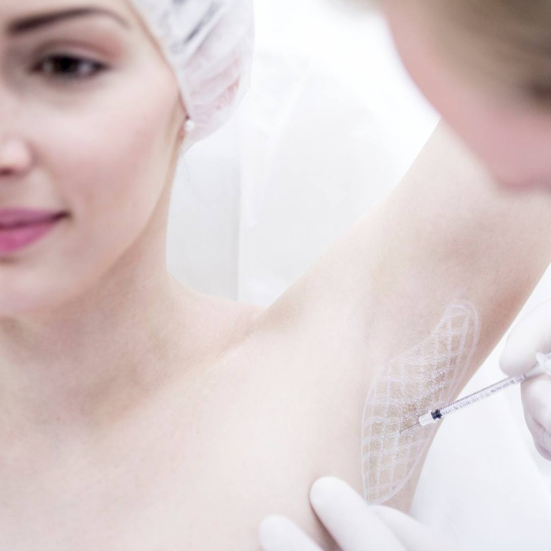 Hiperhidrosis o sudoración excesiva